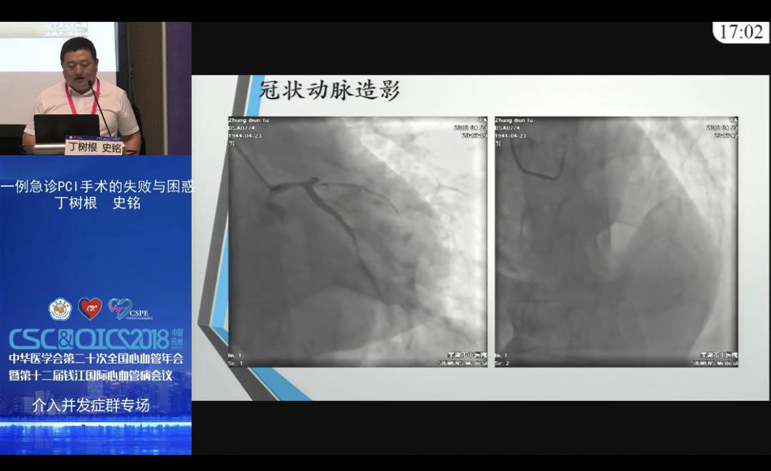 我院心內(nèi)科受邀在2018全國心血管年會(huì)做精彩病例報(bào)告(圖4)