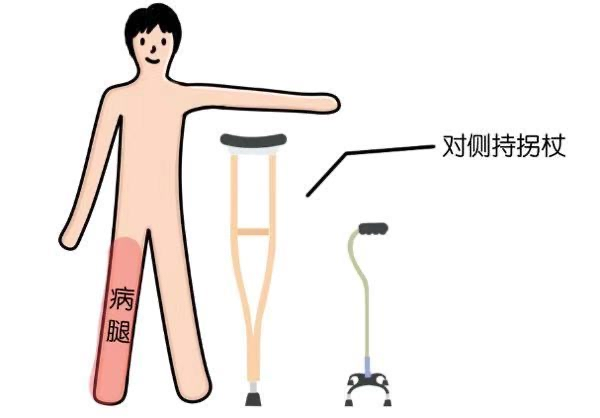 拐杖的“左右為難”——您會正確使用拐杖嗎？(圖2)