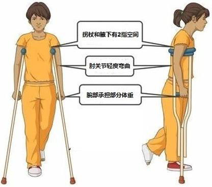 拐杖的“左右為難”——您會正確使用拐杖嗎？(圖4)